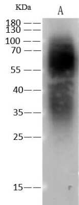 Western Blot: Respiratory Syncytial Virus Glycoprotein G Antibody [NBP3-18801]